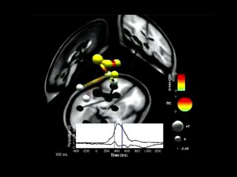 Original Brain Movie 2004